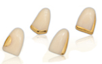 Gold strips on plastic denture teeth