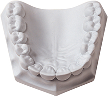 Orthodontic Stone